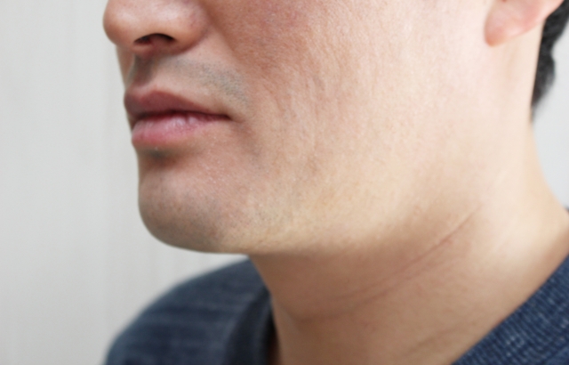 顎が無意識に前に出ていませんか？姿勢の見直しが必要｜八尾市整骨院