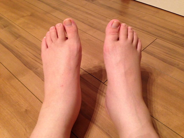 座りっぱなしが原因のむくみ対策！簡単エクササイズ紹介　｜八尾市　オカモト鍼灸整骨院・神経整体院