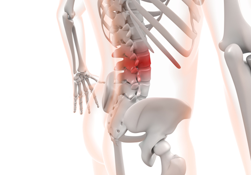 反り腰の治し方、3大原因とは｜八尾市整骨院