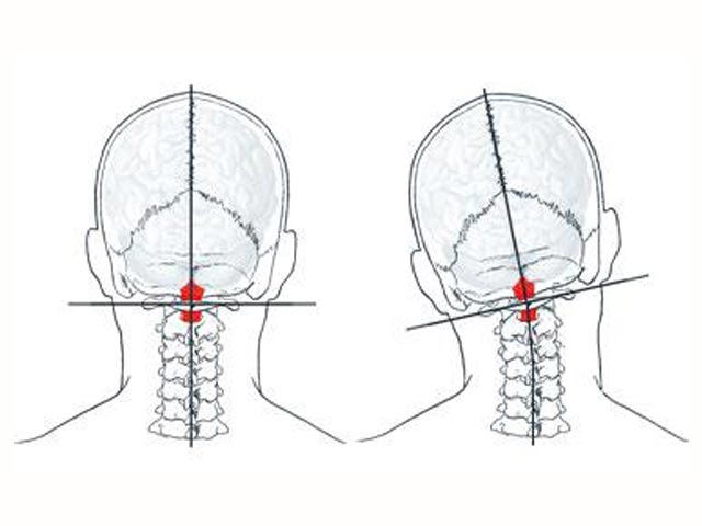 今すぐに直しておかないと危険
