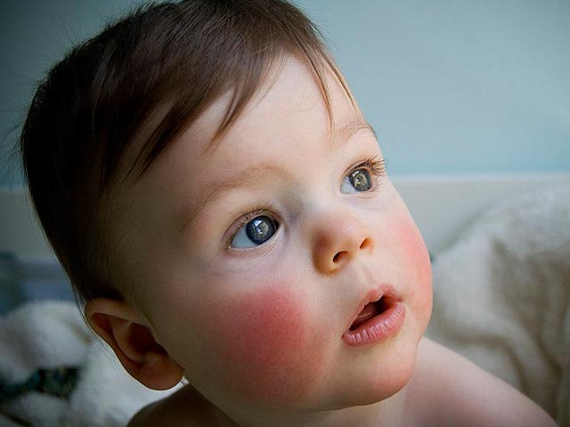 寒くなると鼻が赤くなる原因って？