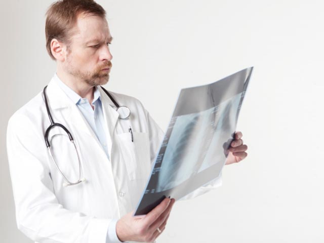 癌になりやすい人にはいくつかの共通点があった