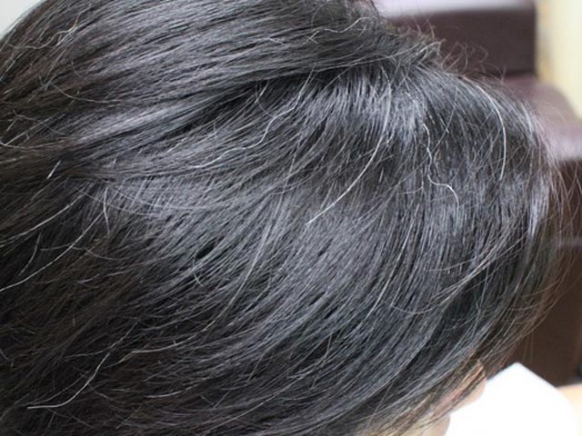 白髪が増えてしまう５つの生活習慣とは｜八尾市整骨院