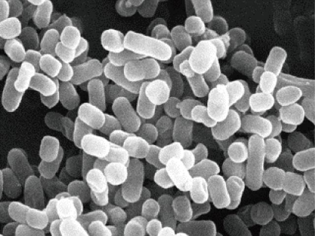 乳酸菌は生きたまま届ける必要がなかった？｜八尾市整骨院