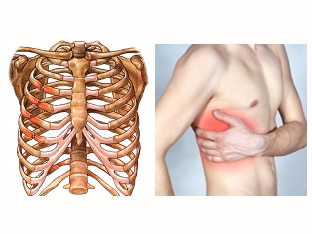 肋骨骨折は意外と大変！｜八尾市整骨院