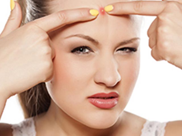 ニキビをできにくくする習慣｜八尾市整骨院